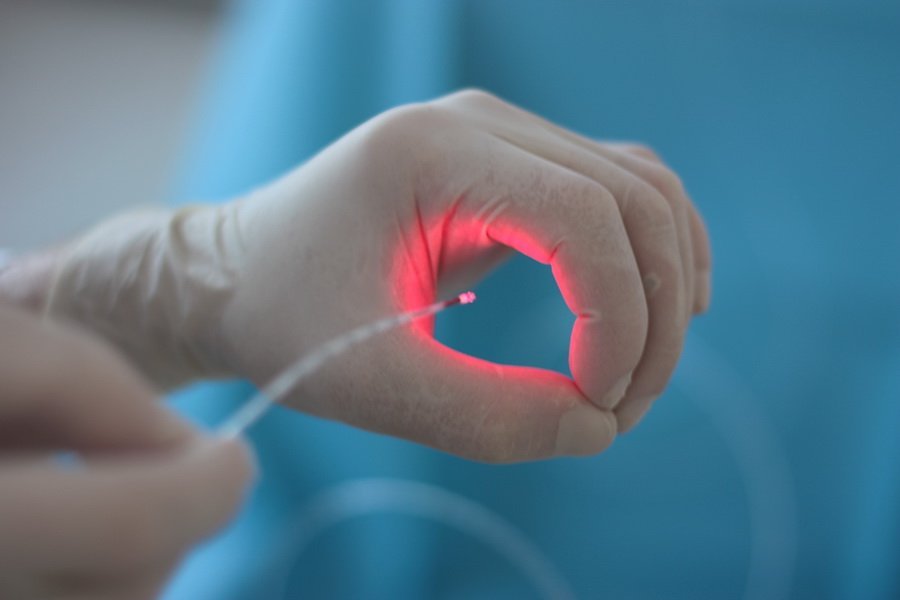 Endovasal Lazer 
